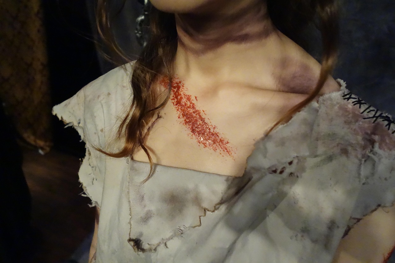 découvrez des conseils essentiels et des informations utiles sur les blessures corporelles. apprenez vos droits, les étapes à suivre après un accident et comment obtenir une juste compensation pour vos préjudices.